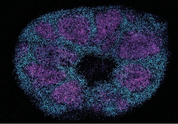 Scientists map key protein interactions linked with profound autism Scientists map key protein interactions linked with profound autism